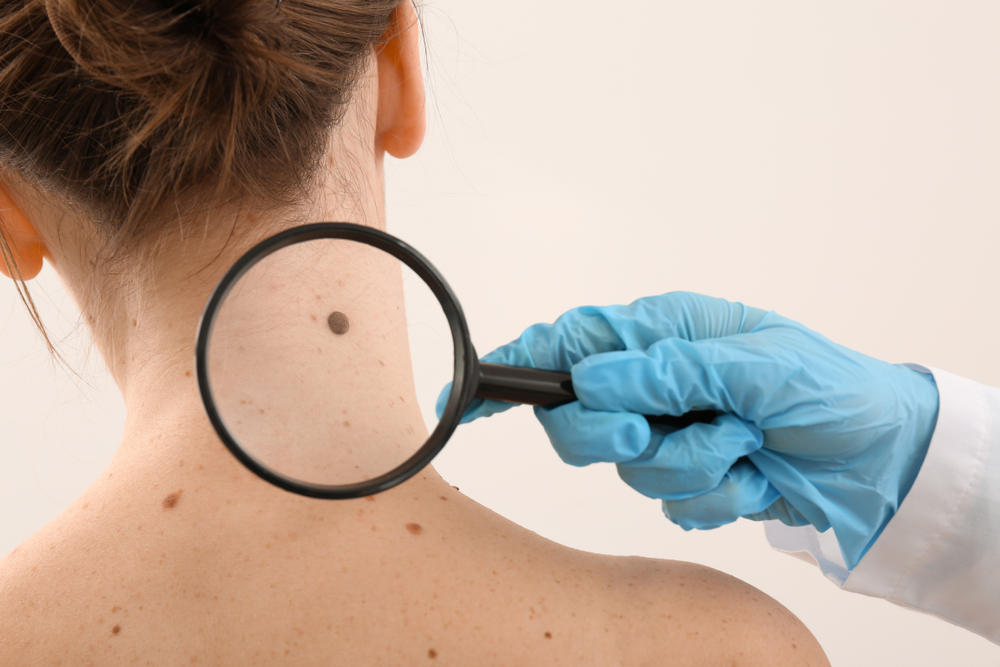 Dermatologist examining moles of patient on light background.