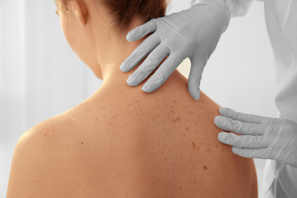 Dermatologist examining patient in clinic.