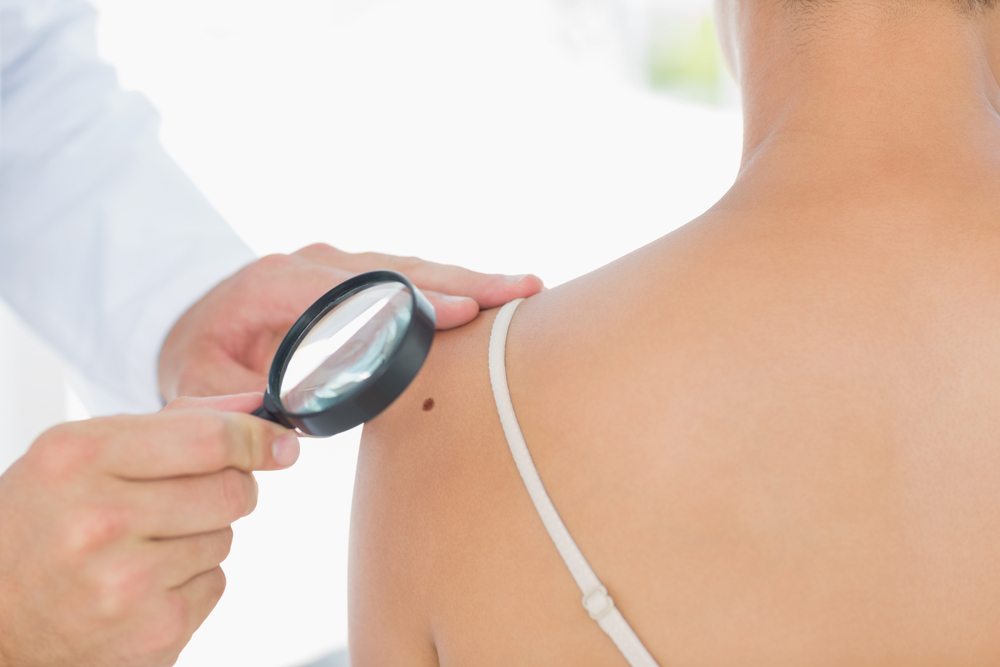 Doctor examining melanoma on woman with magnifying glass in clinic.