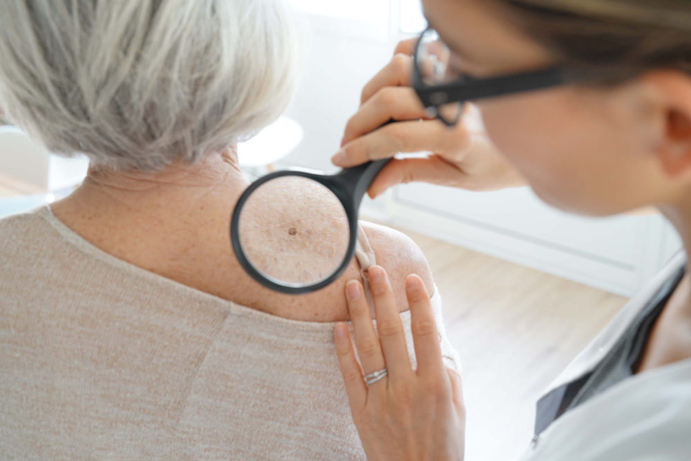 doctor inspecting a woman's mole