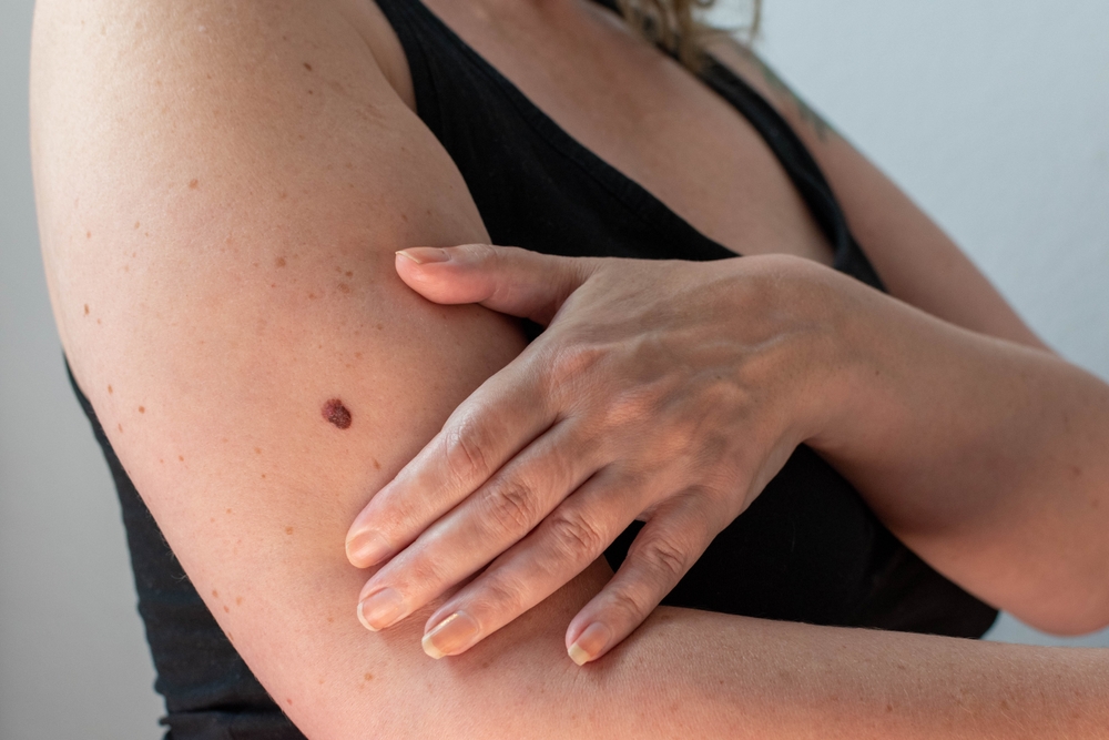 woman checking her skin,